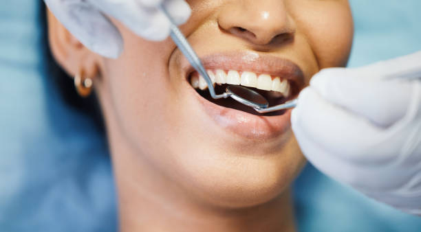 Best Weekend Emergency Dentist in Oroville East, CA