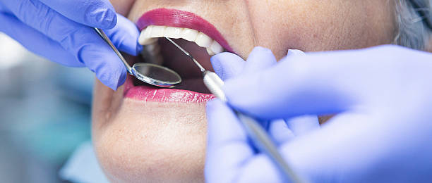 Best Emergency Dental Extractions in Oroville East, CA